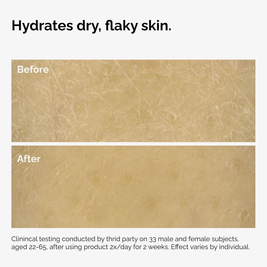 the-body-care-collection-r9 ord-natural-moisturizing-factors-inulin-body-before-after-graphic-02.jpg