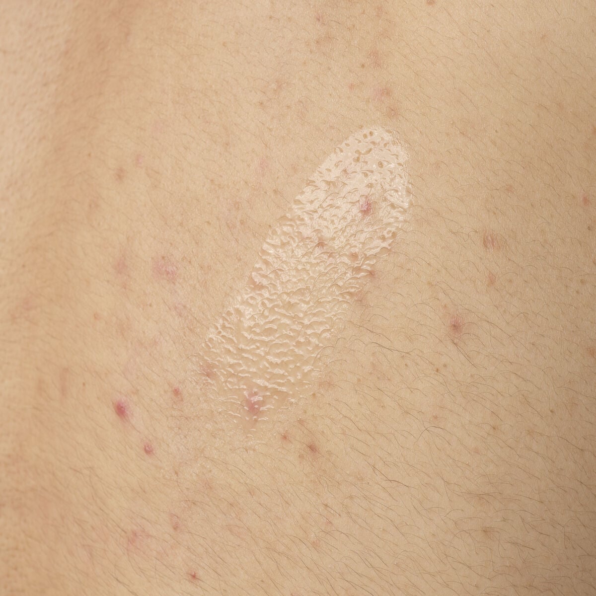 salicylic-acid-0-5-body-serum-j1 ORD-salicylic-acid-05-body-240ml-application.jpg