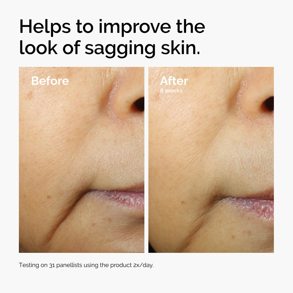 caffeine-3-escin-1-face-serum-t2 ord-caffeine-3pct-escin-1pct-face-serum-before-after-sagging.jpg