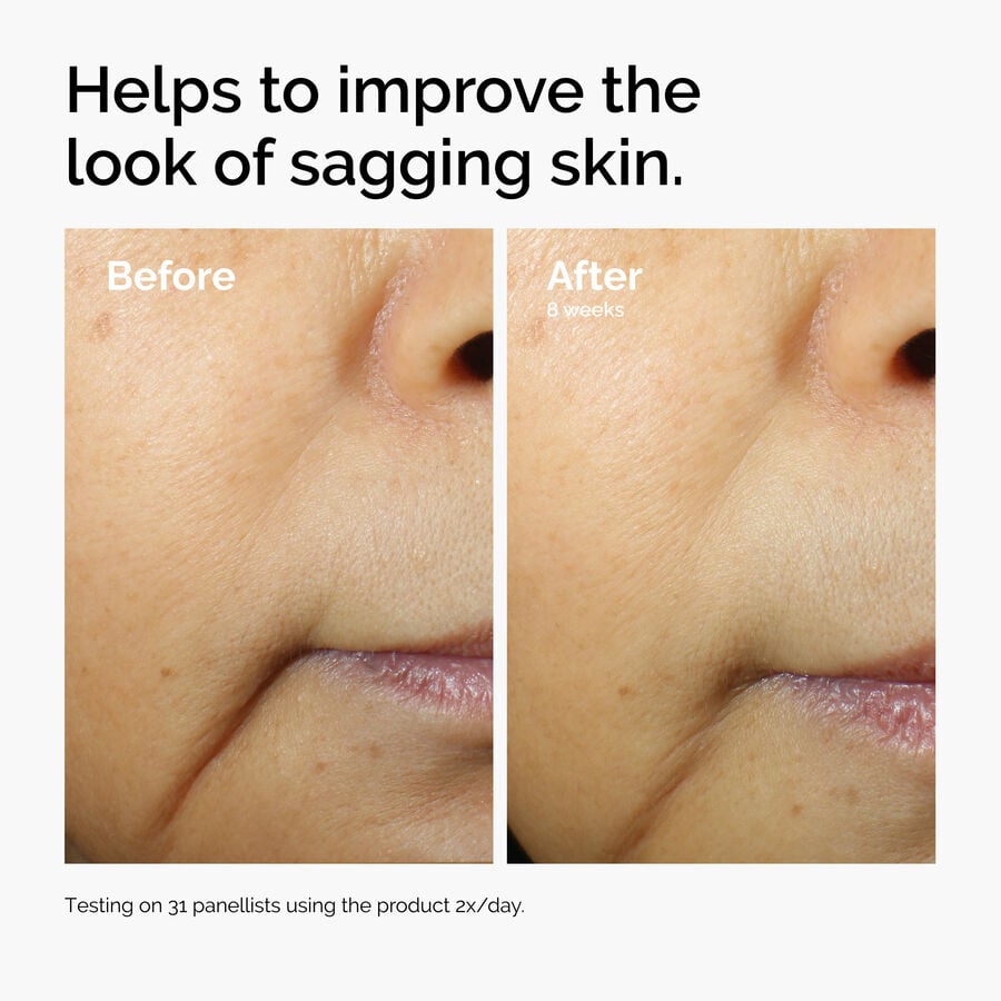 caffeine-3-escin-1-face-serum-t2 ord-caffeine-3pct-escin-1pct-face-serum-before-after-sagging.jpg