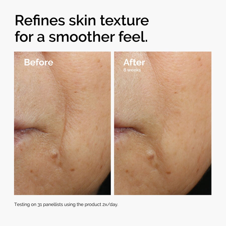 caffeine-3-escin-1-face-serum-t2 ord-caffeine-3pct-escin-1pct-face-serum-before-after-texture.jpg