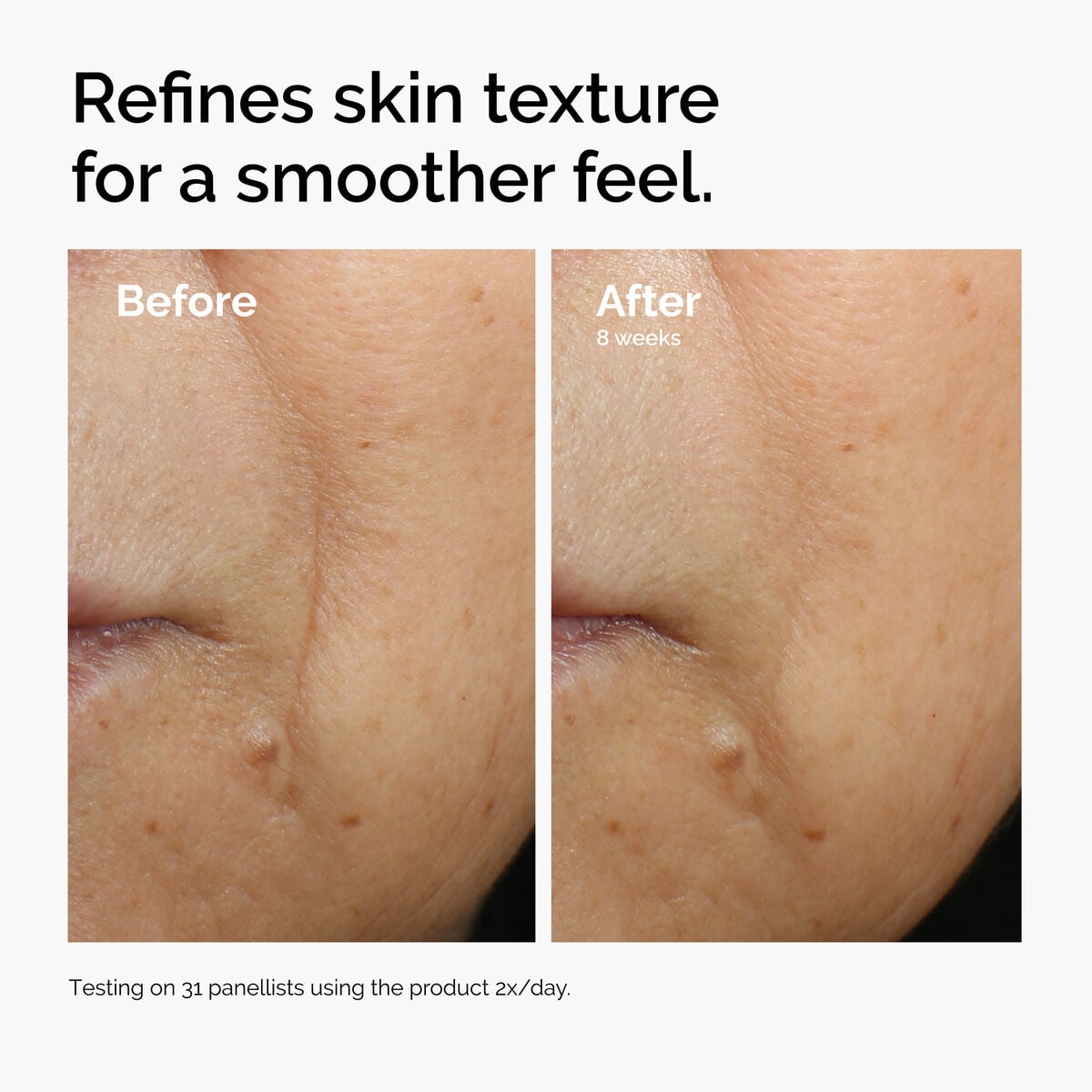 caffeine-3-escin-1-face-serum-t2 ord-caffeine-3pct-escin-1pct-face-serum-before-after-texture.jpg