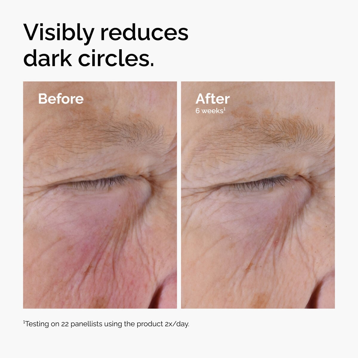 caffeine-solution-5-egcg-eye-serum-c2 ord-caffeine-solution-egcg-dark-circles-before-after.jpg
