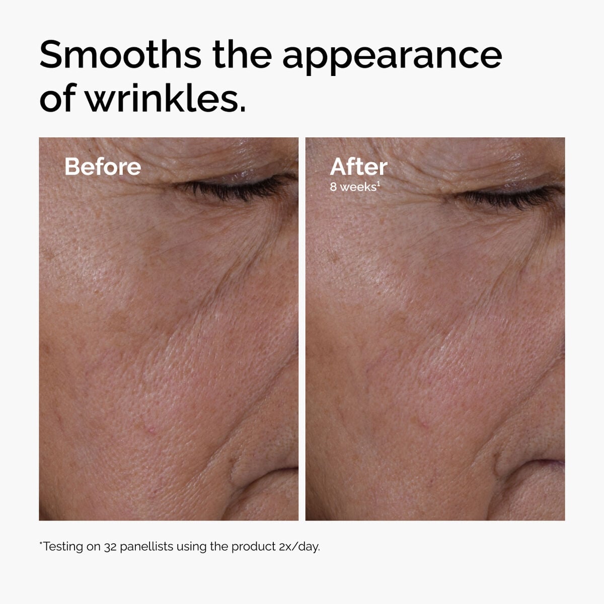 multi-peptide-ha-serum-t8 ord-multi-peptide-ha-serum-wrinkles-before-after.jpg