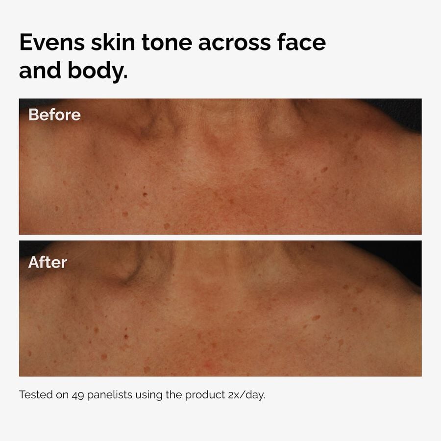 the-body-care-collection-r9 ord-niacinamide-face-body-serum-before-after-even-tone-graphic.jpg