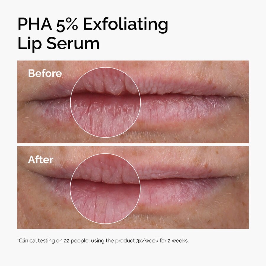 pha-5-exfoliating-lip-serum-p5 ord-pha-5pct-lip-exfoliating-serum-before-after.jpg
